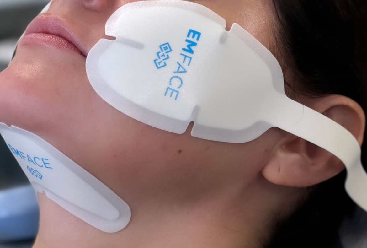 Encise Face Discover the Future of Facial Rejuvenation with Emface – Younique ...