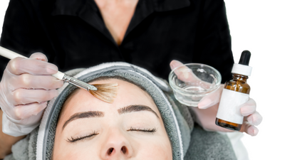 Why Chemical Peels are a Game-Changer for Radiant Skin
