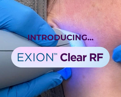 Discover the “Flawless Filter Treatment” at Younique Aesthetics Newry – Exion Clear RF is Here!